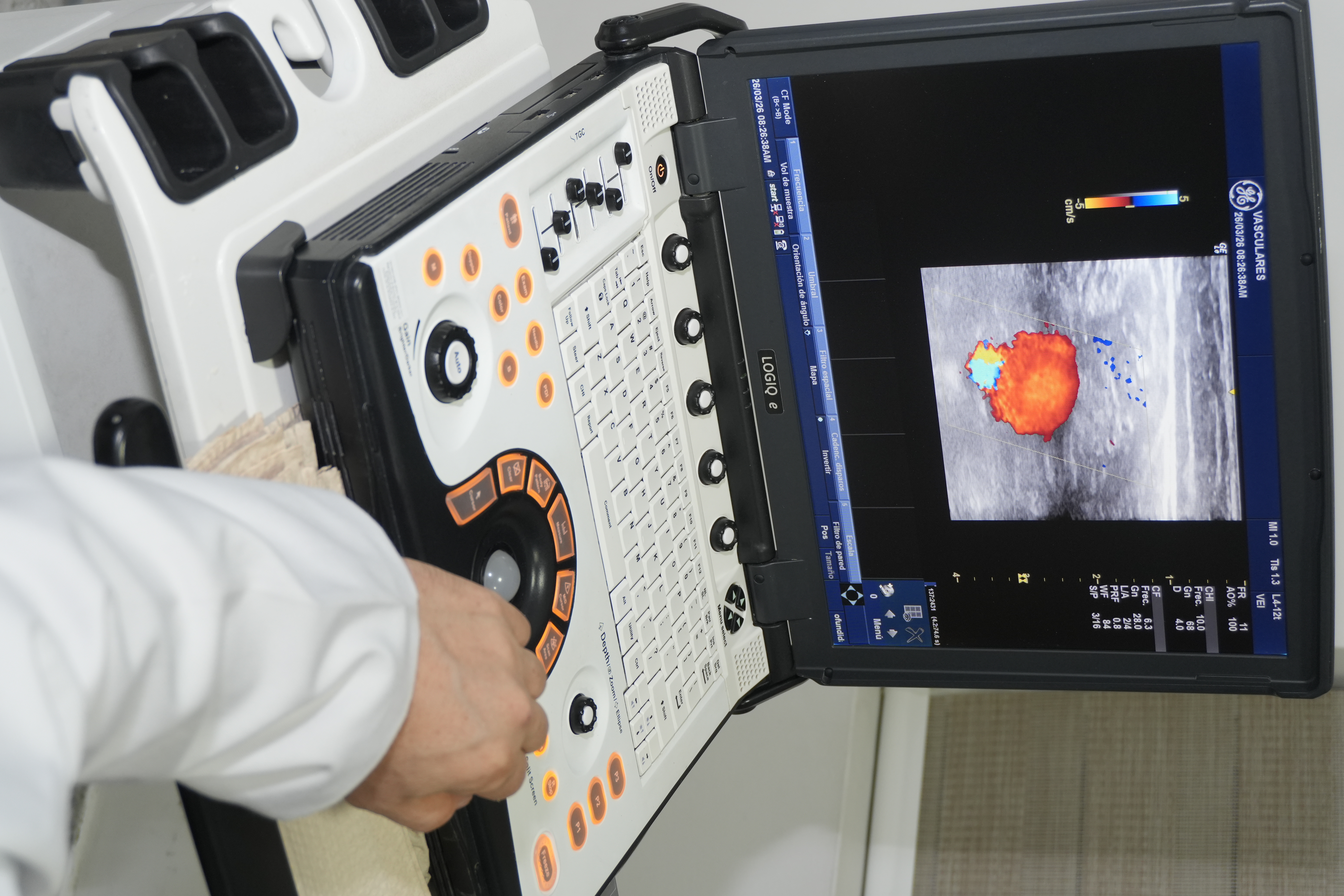Profesional realizando una ecografía Doppler vascular