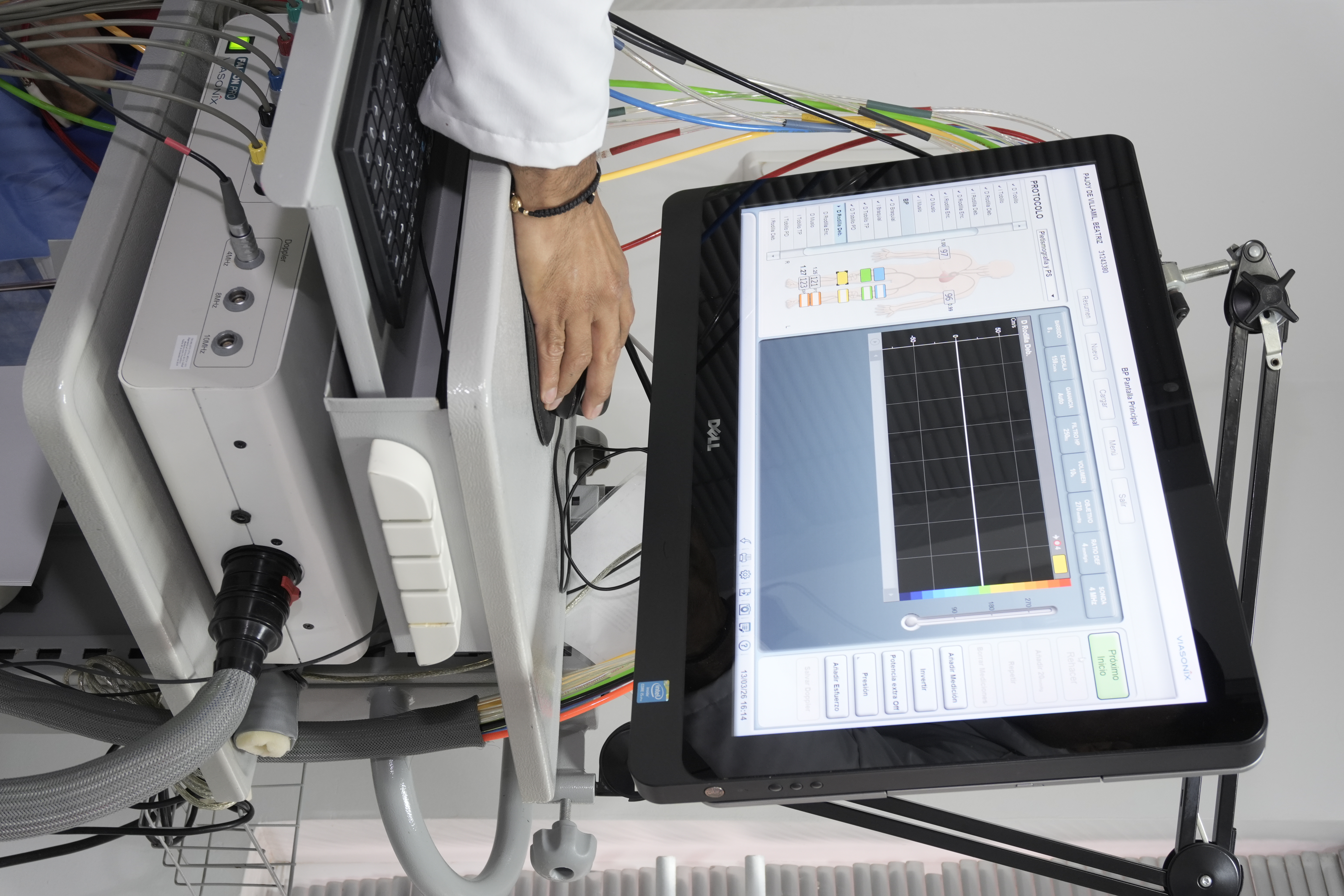 Equipo utilizado para realizar una pletismografía arterial